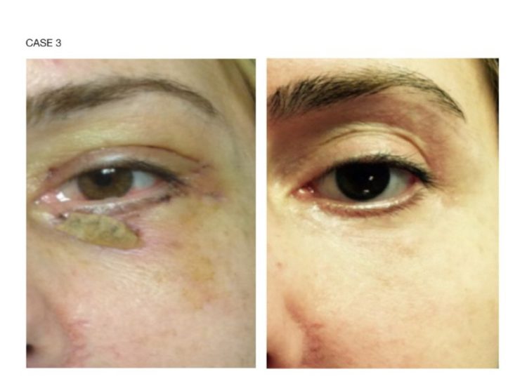 tmp_3464-[10]MFST_resized_02060578890