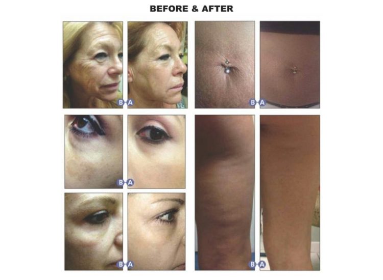 tmp_3464-[11]MFST_resized_0-1425537539