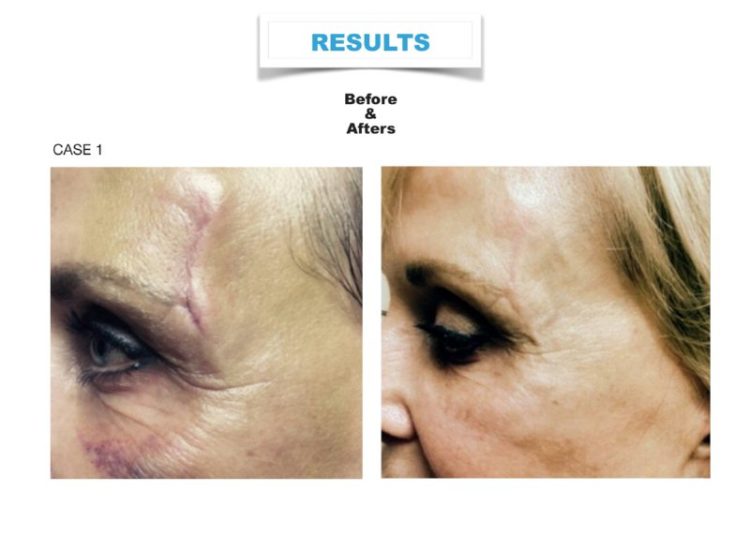 tmp_3464-[8]MFST_resized_01376700973