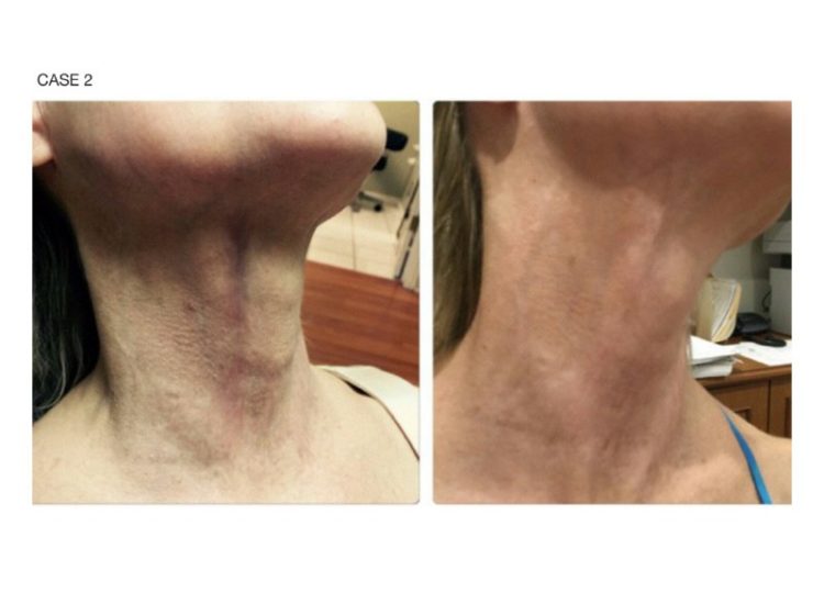 tmp_3464-[9]MFST_resized_0909142059